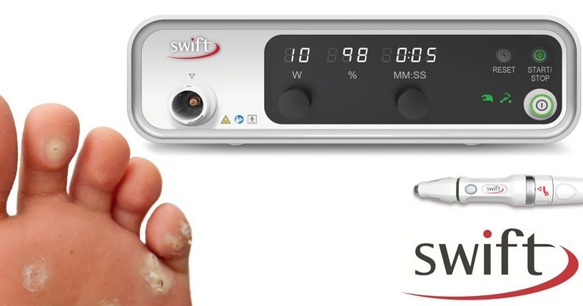 Swift Microwave Therapy uses low-dose microwave energy to heat and treat skin lesions like plantar warts, triggering the body's immune system to fight the underlying HPV virus.