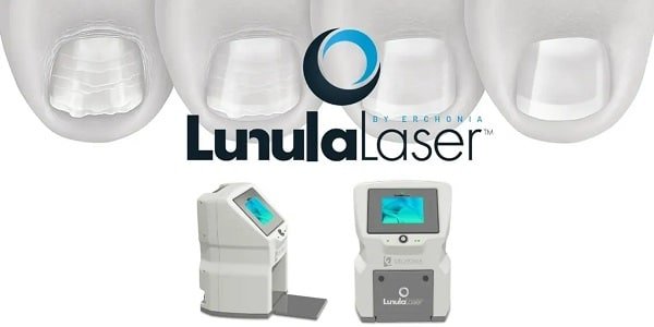 Erchonia laluna laser