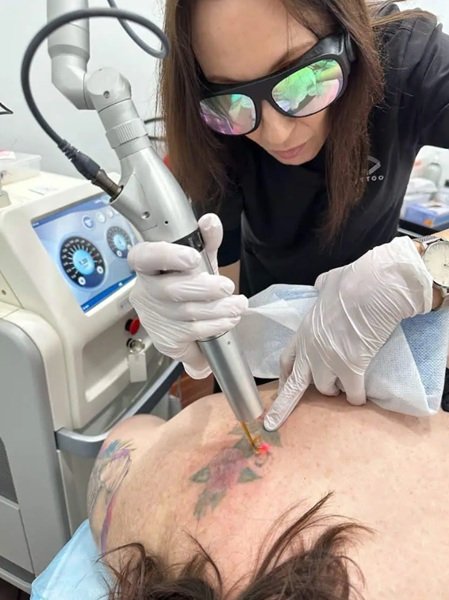 Tattoo Removal Technician