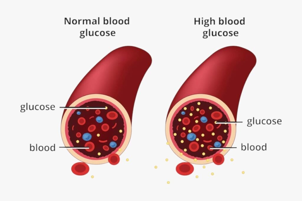 What Is Diabetes?
